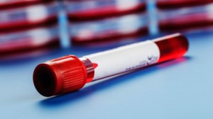 Cancer blood test 300x168