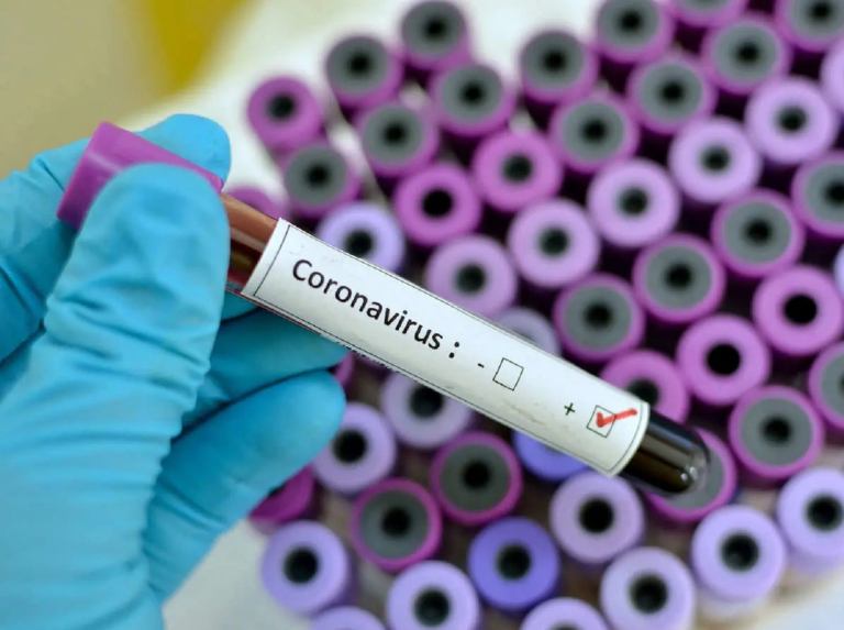 Coronavirus scientist