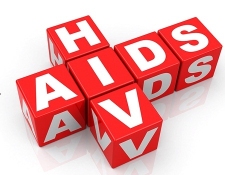 HIV AIDS