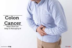 colon cancer