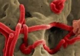 ebola virus