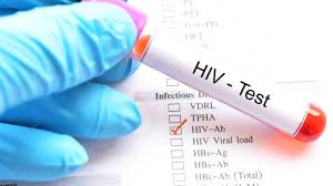 hiv test