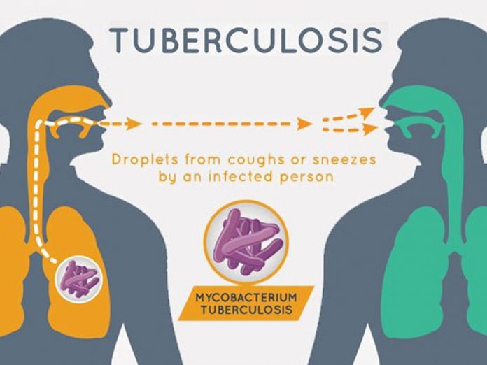 tubercl