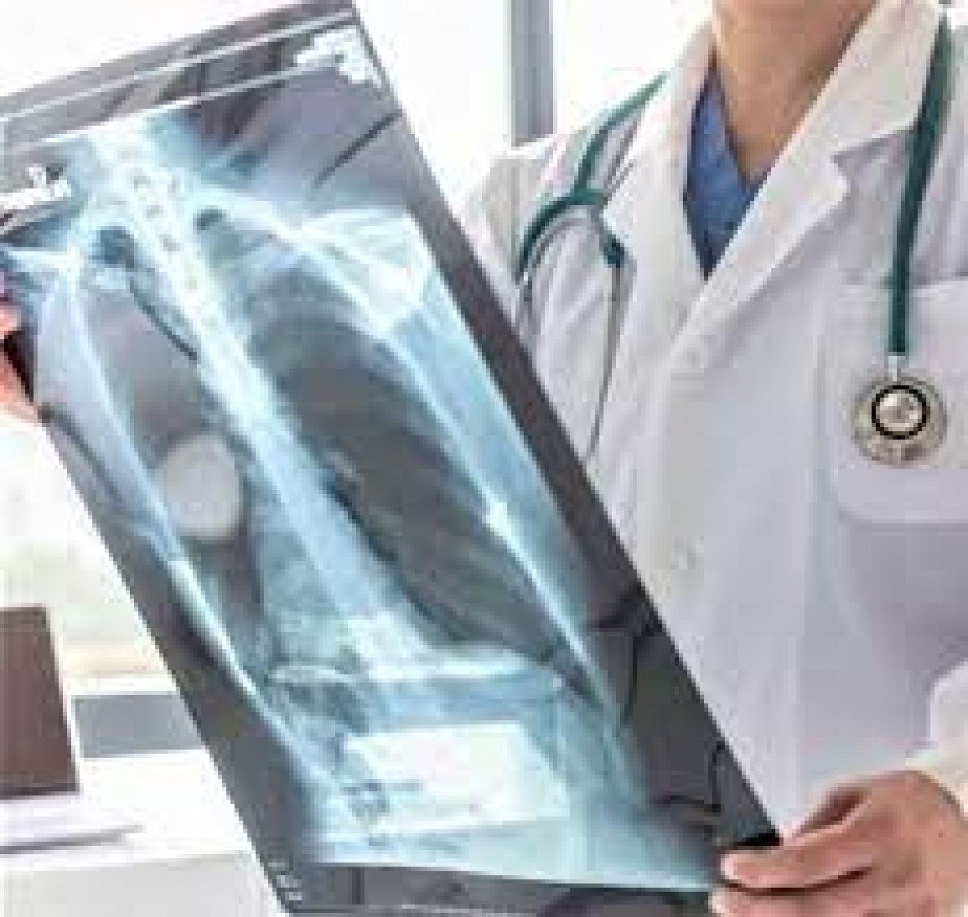 Repeated x-rays could be dangerous, may increase cancer risk, physician warns