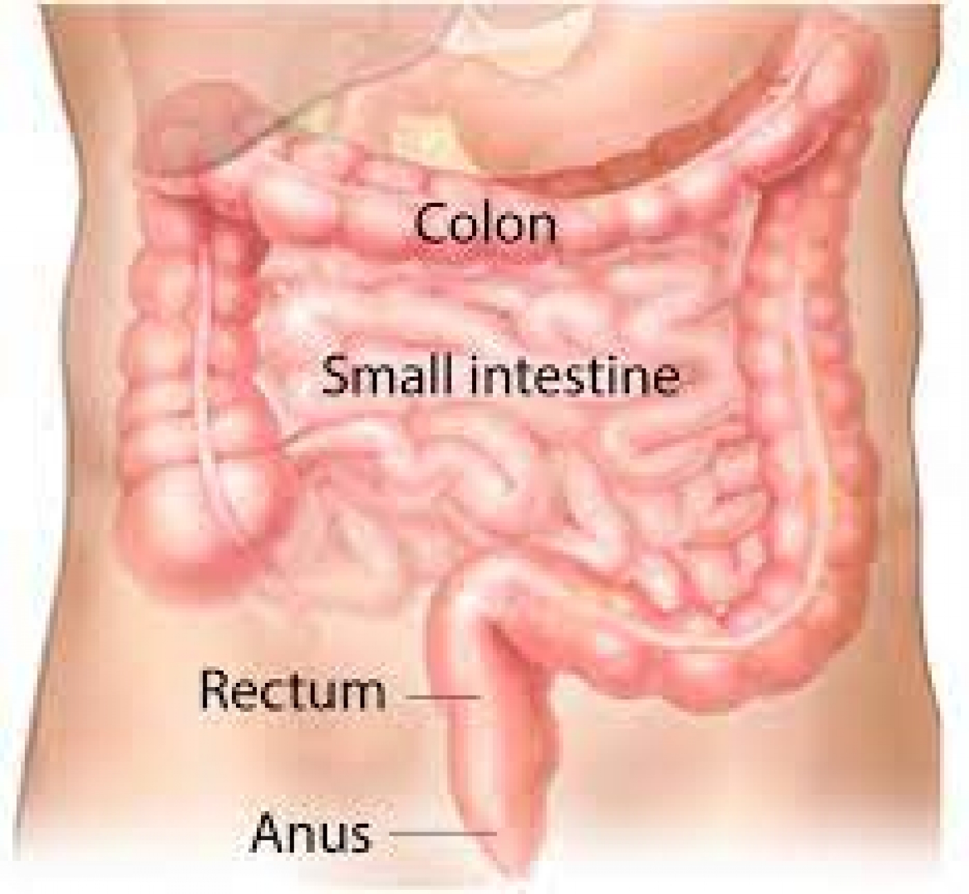 New drug trial shows 100% success rate in rectal cancer treatment