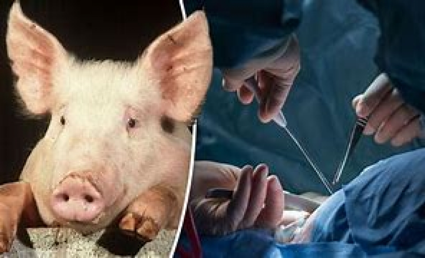 Surgeons perform first pig-to-human kidney transplant