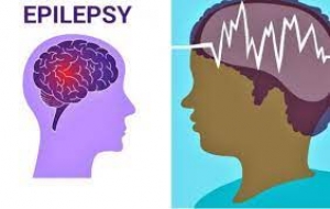 Epilepsy not caused by witchcraft, patients can live normal life with treatment –Neurologists