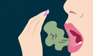 Patients with halitosis exhibit low esteem -Dental expert