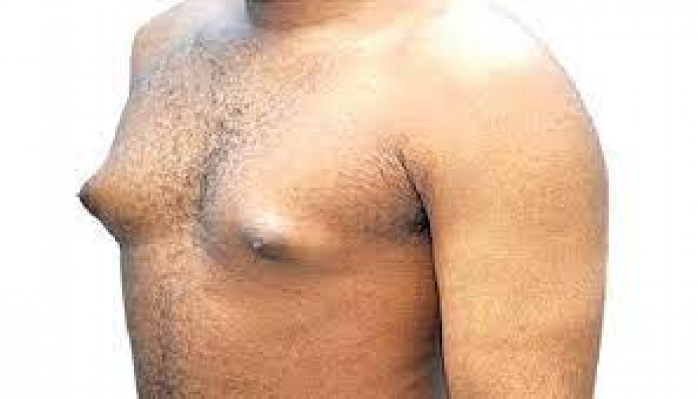 Don’t  ignore enlarged breasts, could be symptom of cancer, liver damage, experts tell men